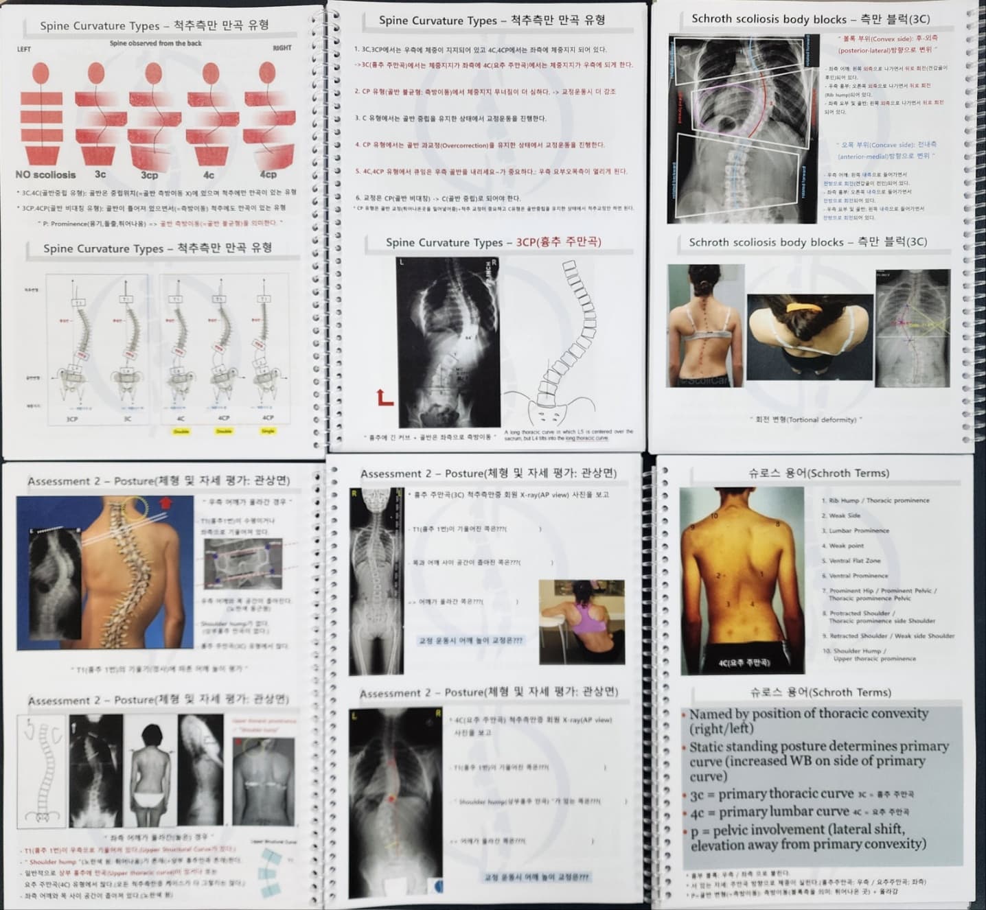 척추측만증 교정 - 독일식 슈로스 운동(Schroth Method) 전문가 과정 Basic Course 6