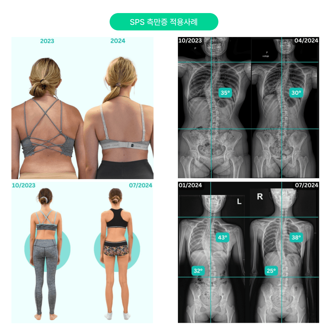 SPS 나선근육 척추안정화 메소드 TRAINER LEVEL 1 COURSE 5