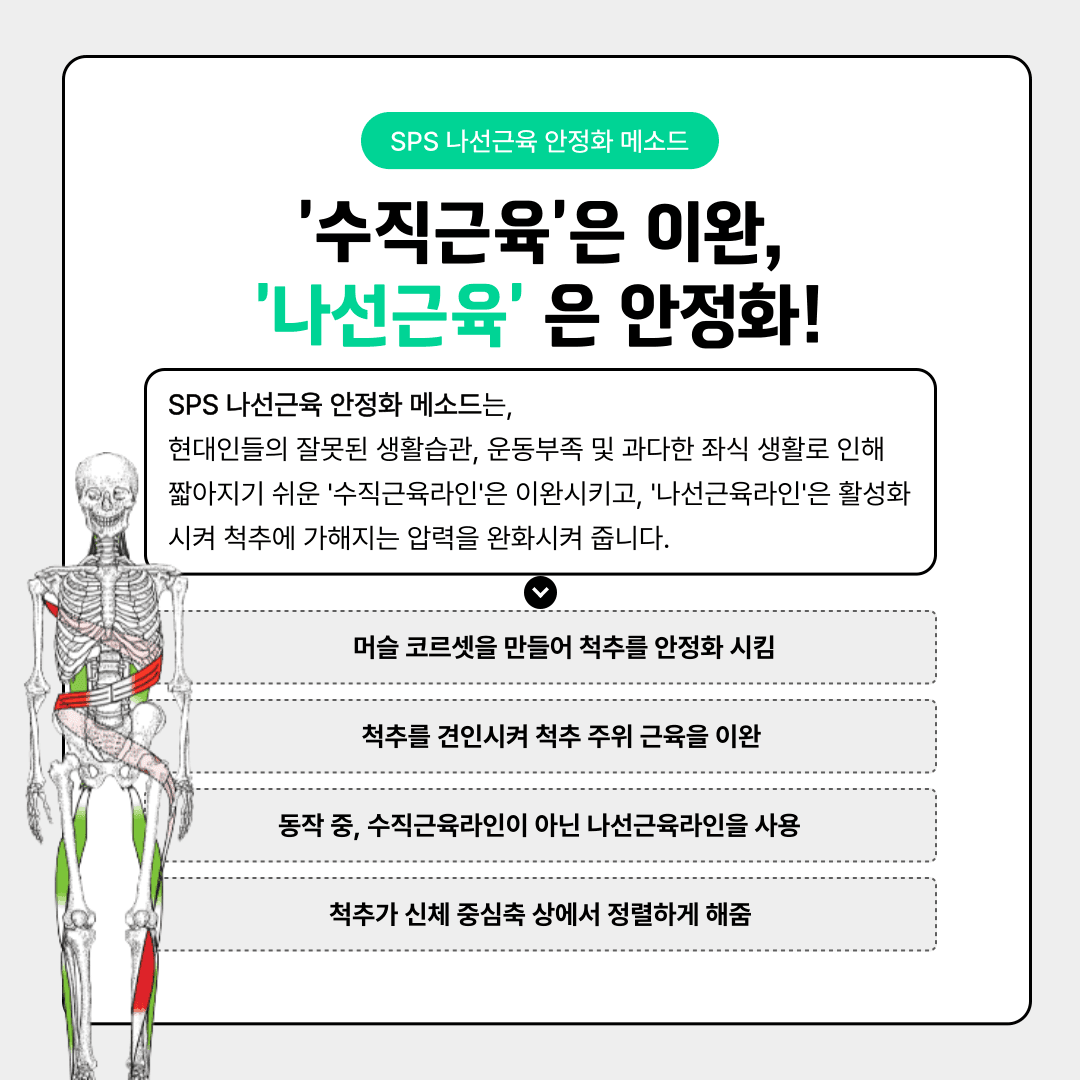 SPS 척추나선근육안정화운동 척추측만증(Scoliosis) 파트 2