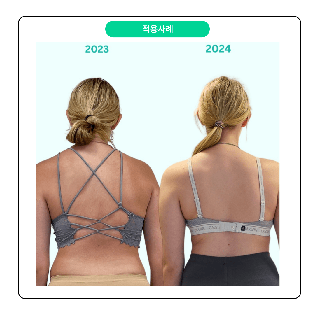 SPS 척추나선근육안정화운동 척추측만증(Scoliosis) 파트 5