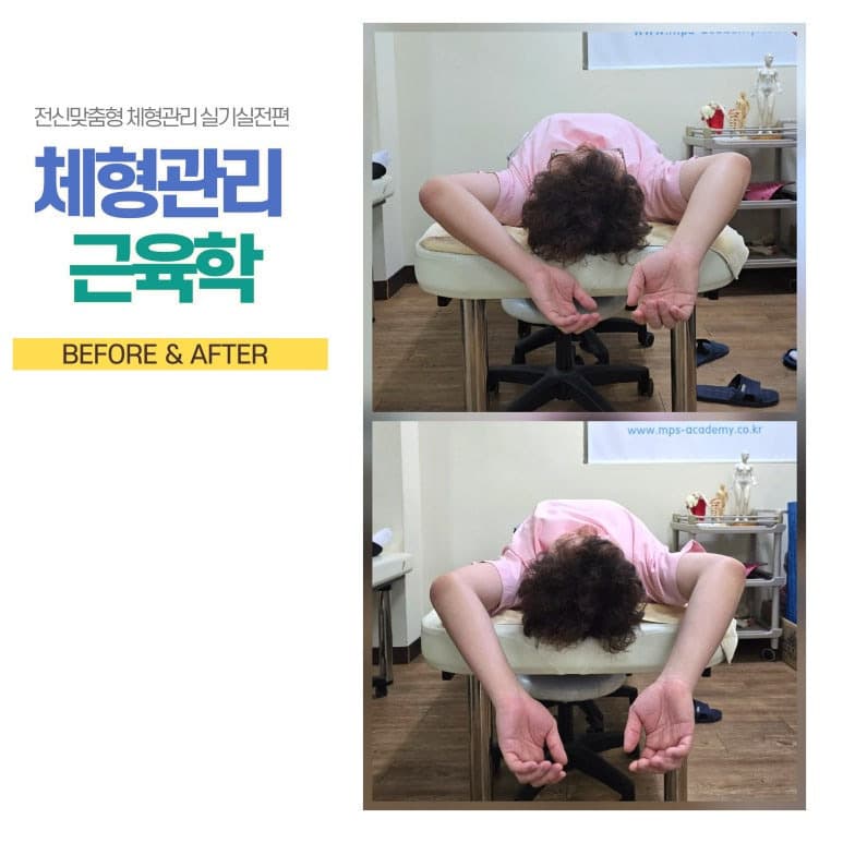 체형관리 근육학 (5주 과정) - MPS 체형관리사 2급 자격증 취득 3