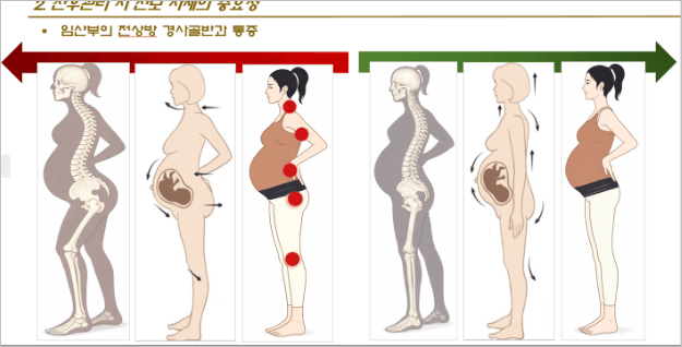 송자 박사의 산전·산후 관리 56기 산모관리 전문가 과정 (기초반) 8